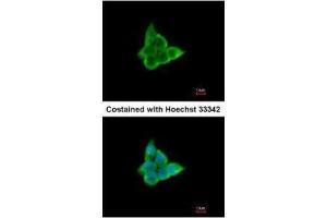 ICC/IF Image Immunofluorescence analysis of paraformaldehyde-fixed A431, using CIS, antibody at 1:200 dilution.
