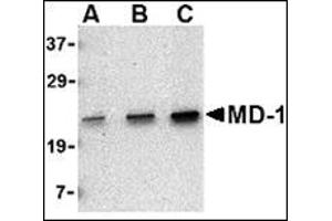 Western blot analysis of MD-1 in Daudi cell lysate with this product at (A) 0.