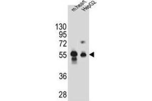 Image no. 1 for anti-Dipeptidase 3 (DPEP3) antibody (ABIN2995842)