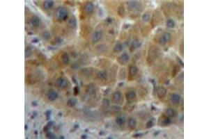 Image no. 3 for anti-Retinol Binding Protein 5, Cellular (RBP5) (AA 19-201) antibody (ABIN1078489)