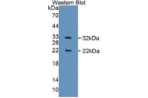 anti-Topoisomerase (DNA) II Binding Protein 1 (TOPBP1) (AA 1-246) antibody