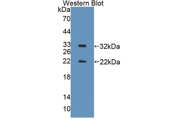anti-Topoisomerase (DNA) II Binding Protein 1 (TOPBP1) (AA 1-246) antibody