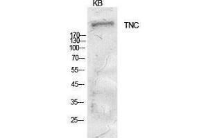 Image no. 1 for anti-Tenascin C (TNC) (Internal Region) antibody (ABIN3181403)