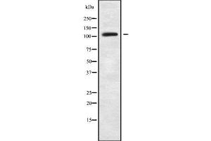 Image no. 1 for anti-Zinc Finger Protein 280D (ZNF280D) (Internal Region) antibody (ABIN6266122)