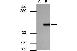 Image no. 3 for anti-rho-Associated, Coiled-Coil Containing Protein Kinase 1 (ROCK1) (N-Term) antibody (ABIN2856887)