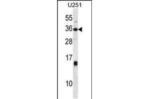 Image no. 1 for anti-Stanniocalcin 1 (STC1) (AA 193-221), (C-Term) antibody (ABIN5532152)