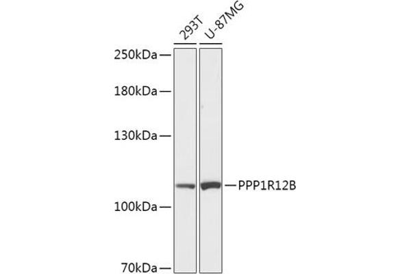 PPP1R12B Antikörper  (AA 660-930)