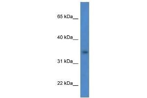Image no. 1 for anti-Hydroxysteroid Dehydrogenase Like 1 (HSDL1) (N-Term) antibody (ABIN926558)