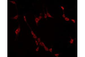 Image no. 2 for anti-Coiled-Coil Domain Containing 102B (CCDC102B) (Internal Region) antibody (ABIN6258941)