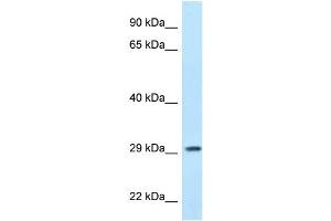 WB Suggested Anti-PPP1R3B Antibody Titration: 1.