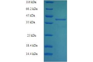 Image no. 1 for RAB27B, Member RAS Oncogene Family (RAB27B) (AA 2-218) protein (His-SUMO Tag) (ABIN5710203)