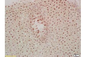 Image no. 6 for anti-Macrophage Stimulating 1 (Hepatocyte Growth Factor-Like) (MST1) (AA 385-487) antibody (ABIN747308)