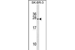 TUSC5 Antibody (Center) (ABIN1538619 and ABIN2849448) western blot analysis in SK-BR-3 cell line lysates (35 μg/lane).