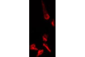 Image no. 1 for anti-MOB Kinase Activator 1B (MOB1B) (N-Term) antibody (ABIN6257009)