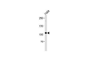 UBE3C antibody  (AA 549-578)