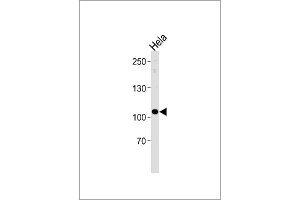 UBE3C antibody  (AA 549-578)