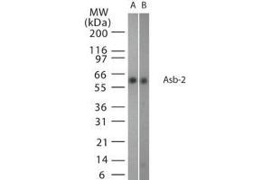 anti-Ankyrin Repeat and SOCS Box-Containing 2 (ASB2) (AA 75-93) antibody