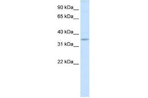 Image no. 1 for anti-TGFB-Induced Factor Homeobox 2-Like, X-Linked (TGIF2LX) (Middle Region) antibody (ABIN2780122)