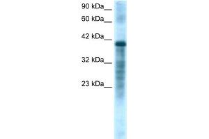 Image no. 1 for anti-Proteasome (Prosome, Macropain) 26S Subunit, ATPase, 3 (PSMC3) (Middle Region) antibody (ABIN2777668)