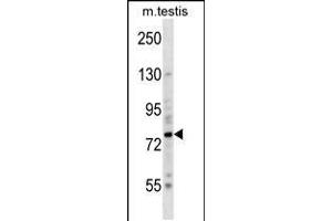 Image no. 1 for anti-BR serine/threonine Kinase 2 (BRSK2) (AA 329-356) antibody (ABIN5536941)