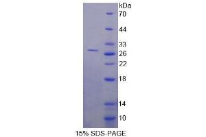 Image no. 1 for DNA (Cytosine-5-)-Methyltransferase 3 beta (DNMT3B) (AA 581-859) protein (His tag) (ABIN6237244)
