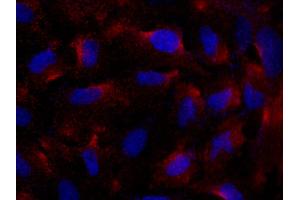 Image no. 1 for anti-Fc Fragment of IgE Receptor Ia (FCER1A) (AA 1-205) antibody (ABIN6923879)