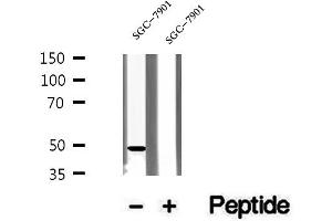 Image no. 1 for anti-Ubiquinol-Cytochrome C Reductase Core Protein II (UQCRC2) (Internal Region) antibody (ABIN6265900)