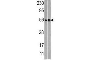 NMD3 antibody  (C-Term)