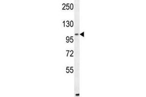 Image no. 2 for anti-Aldehyde Dehydrogenase 1 Family, Member L2 (ALDH1L2) (AA 743-772) antibody (ABIN3028458)