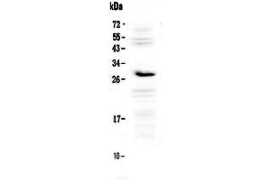 Image no. 1 for anti-Interleukin 1 Receptor Antagonist (IL1RN) (AA 27-178) antibody (ABIN5518925)