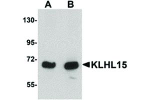 Image no. 1 for anti-Kelch-Like 15 (KLHL15) (C-Term) antibody (ABIN6656876)
