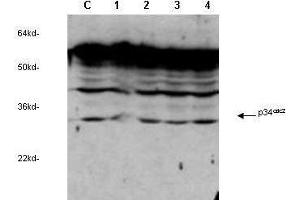 anti-cdc2 Cyclin Dependent Kinase  was used to detect human p34cdc2by western blot in untreated (Contol) and drug treated lysates of MCF-7 cells.
