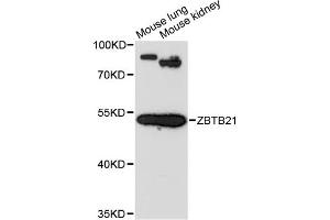 Image no. 1 for anti-Zinc Finger Protein 295 (ZNF295) antibody (ABIN6291079)