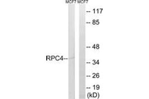 Image no. 1 for anti-Polymerase (RNA) III (DNA Directed) Polypeptide D, 44kDa (POLR3D) (AA 281-330) antibody (ABIN1534847)