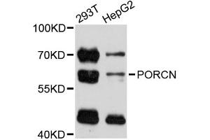 Image no. 1 for anti-Porcupine Homolog (PORCN) antibody (ABIN6292716)