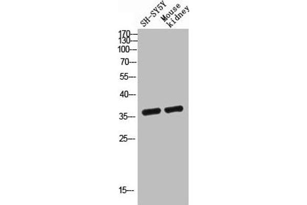 G Protein-Coupled Receptor 119 antibody  (Internal Region)