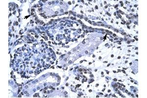 Image no. 1 for anti-Forkhead Box G1 (FOXG1) (N-Term) antibody (ABIN629820)