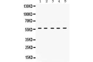 Image no. 2 for anti-Lymphocyte-Specific Protein tyrosine Kinase (LCK) (AA 468-506), (C-Term) antibody (ABIN3043870)