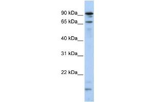 Image no. 1 for anti-Male-Specific Lethal 2 Homolog (MSL2) antibody (ABIN2458724)