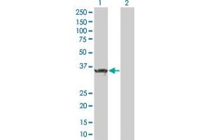 Image no. 1 for anti-Zinc Finger and BTB Domain Containing 32 (ZBTB32) (AA 1-302) antibody (ABIN525807)