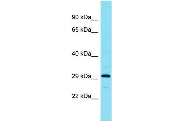 anti-ADP-Ribosylhydrolase Like 1 (ADPRHL1) (Middle Region) antibody