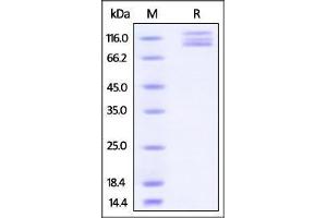 Image no. 2 for ITGAV/ITGB3 (ITGAV/ITGB3) (AA 31-992) (Active) protein (His tag) (ABIN2870663)
