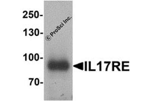 Image no. 1 for anti-Interleukin 17 Receptor E (IL17RE) antibody (ABIN1077424)