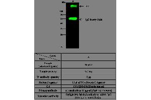 Image no. 2 for anti-Fibronectin 1 (FN1) (AA 607-1265) antibody (ABIN1996361)