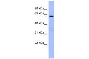 Image no. 1 for anti-Plastin 1 (PLS1) (AA 71-120) antibody (ABIN6744070)