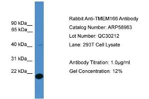 Image no. 2 for anti-Family with Sequence Similarity 176, Member A (FAM176A) (Middle Region) antibody (ABIN2787894)
