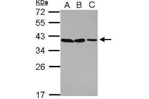 WB Image Sample (30 ug of whole cell lysate) A: A549 B: H1299 C: HCT116 12% SDS PAGE antibody diluted at 1:1000