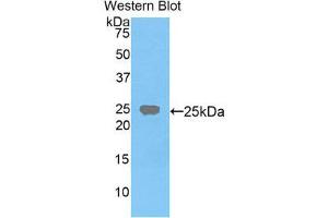 Image no. 1 for anti-Farnesyl-Diphosphate Farnesyltransferase 1 (FDFT1) (AA 217-416) antibody (ABIN1858844)