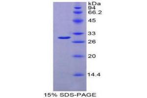 Image no. 1 for Interferon alpha/beta Receptor 1 (IFNAR1) (AA 104-341) protein (His tag) (ABIN1879548)
