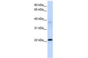 Image no. 1 for anti-Chromosome 11 Open Reading Frame 74 (C11ORF74) (C-Term) antibody (ABIN6741150)